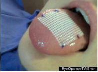 this is a photo of a tongue patch